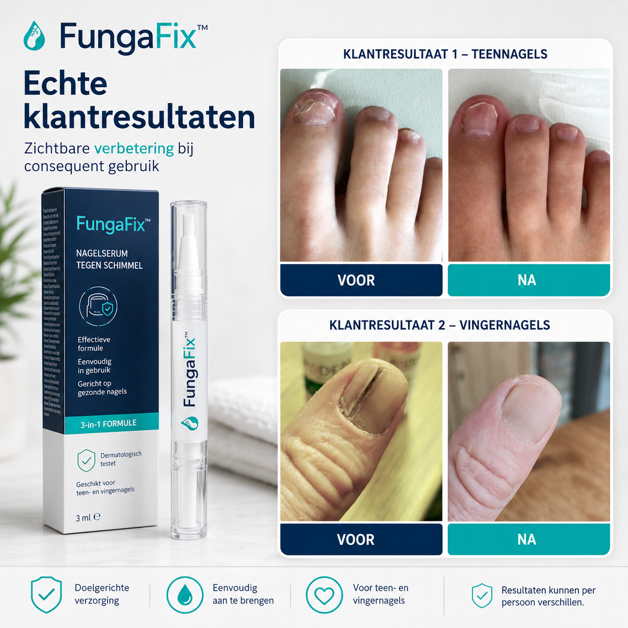 FungaFix™ Schimmelnagel Pen - Sozofy